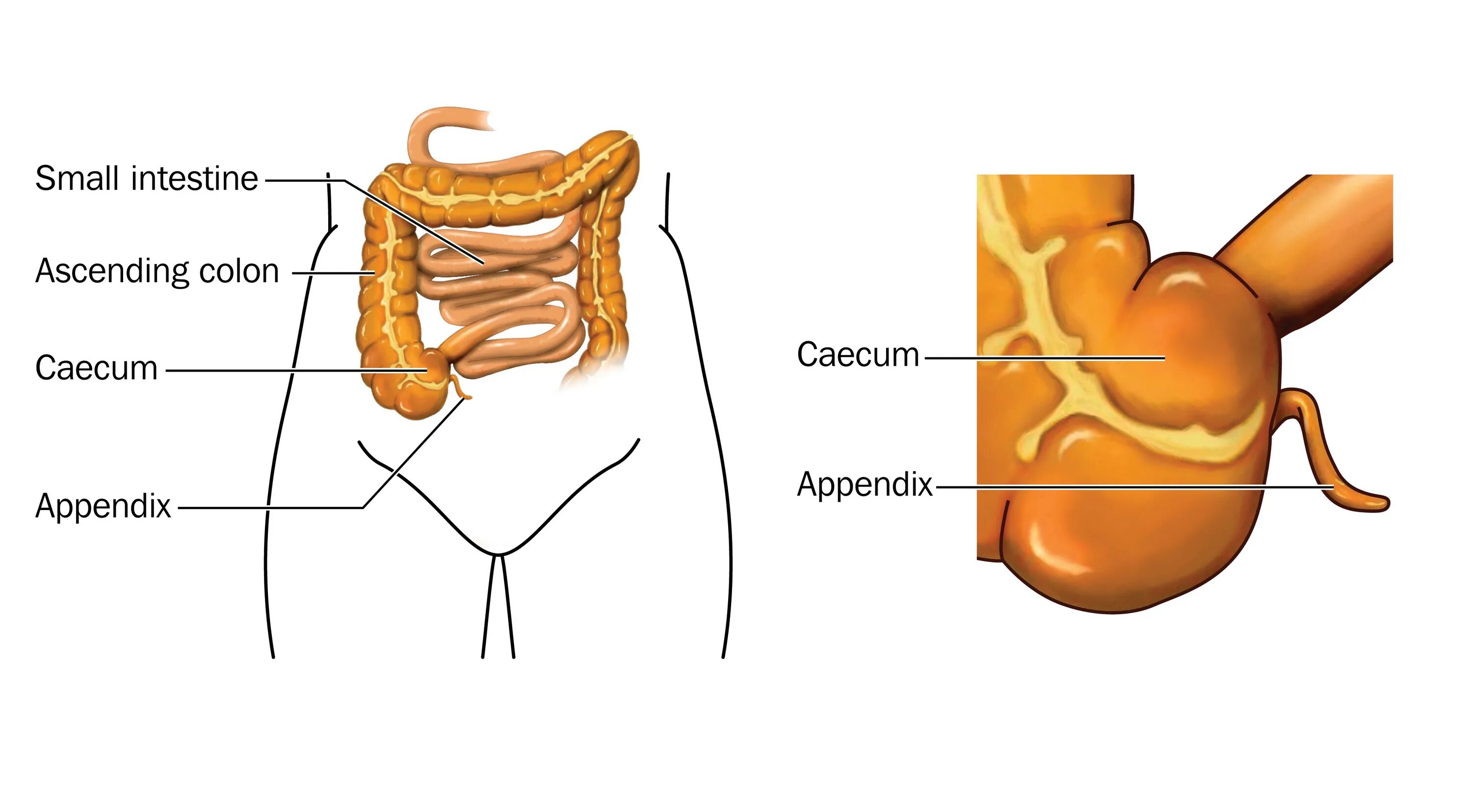 Слепая кишка рисунок. Червеобразный отросток слепой кишки. Аппендикс это отросток слепой кишки. Слепая кишка с аппендиксом. Червеобразный отросток у кишки.