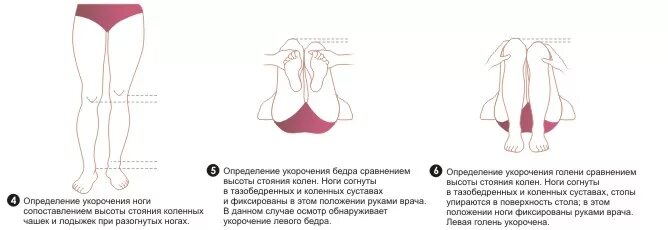Как будет по другому ноги