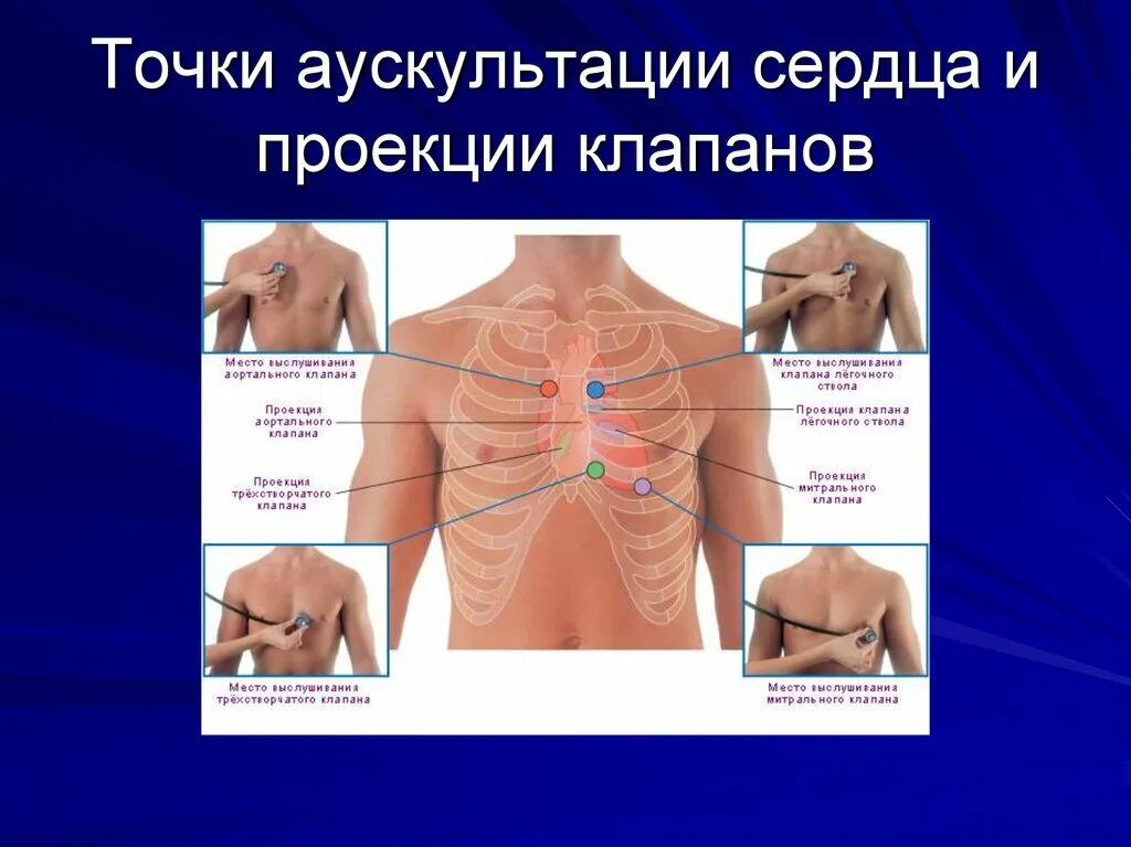 Точка выслушивания митрального клапана. Аускультация клапанов сердца анатомия. Аускультация аортального клапана. Точки выслушивания клапанов сердца. Аускультация сердца межребкр.