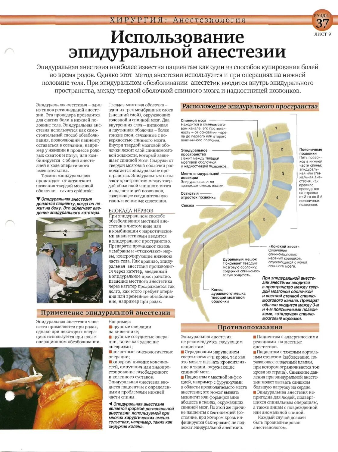 Эпидуралка болит спина. Эпидуральная анестезия при операции. Эпидуральная анестезия вводится в. После эпидуральной анестезии. Эпидуральная анестезия количество анестетика.