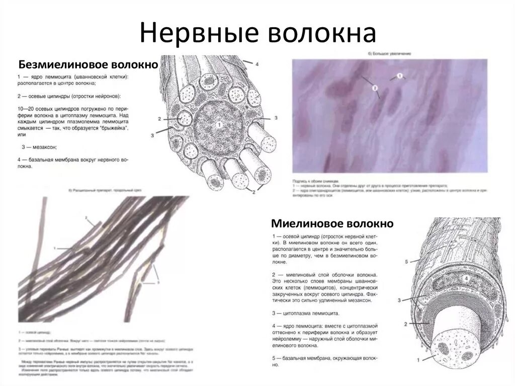 Нейролеммоциты. Нервные волокна серые. Характеристика нервных волокон. Мембрана нервного волокна. Безмиелиновые нервные волокна препарат гистология.