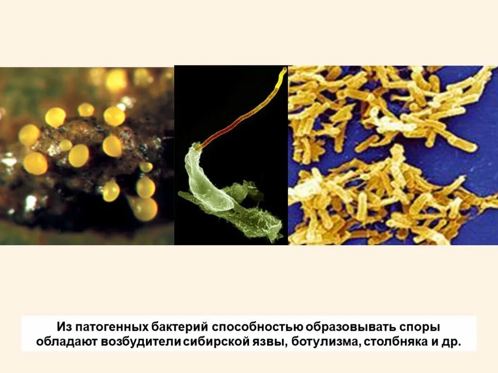 Болезнетворная бактерия 7. Болезнетворные бактерии. Болезнетворные бактерии патогенные. Болезнетворные бактерии столбняк. Способностью образовывать споры обладают бактерии.