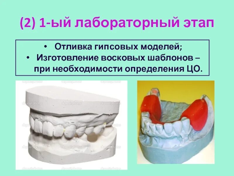 Изготовление гипсовой модели. Отливка гипсовых моделей. Требования к восковым базисам с окклюзионными валиками. Восковой Базис с прикусными валиками. Изготовление гипсовых моделей.