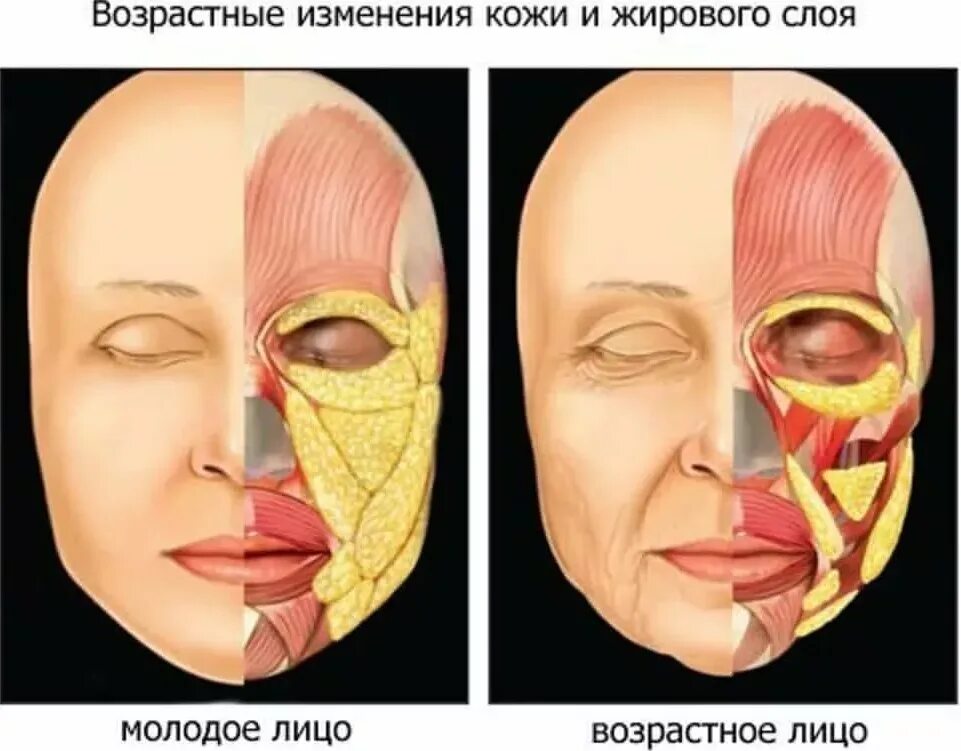 Жировой на лице. Мышцы лица и жировые пакеты. поверхностные жировые пакеты лица. жировые пакеты на лице анатомия.