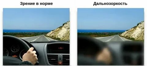 Зрение плюс 1 75