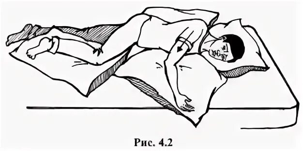 Размещение пациента в положение лежа на боку. Положение пациента на боку с пролежнями. Положение Фаулера при инсульте. Положение Фаулера и положение симса. В зависимости от того какой лежит