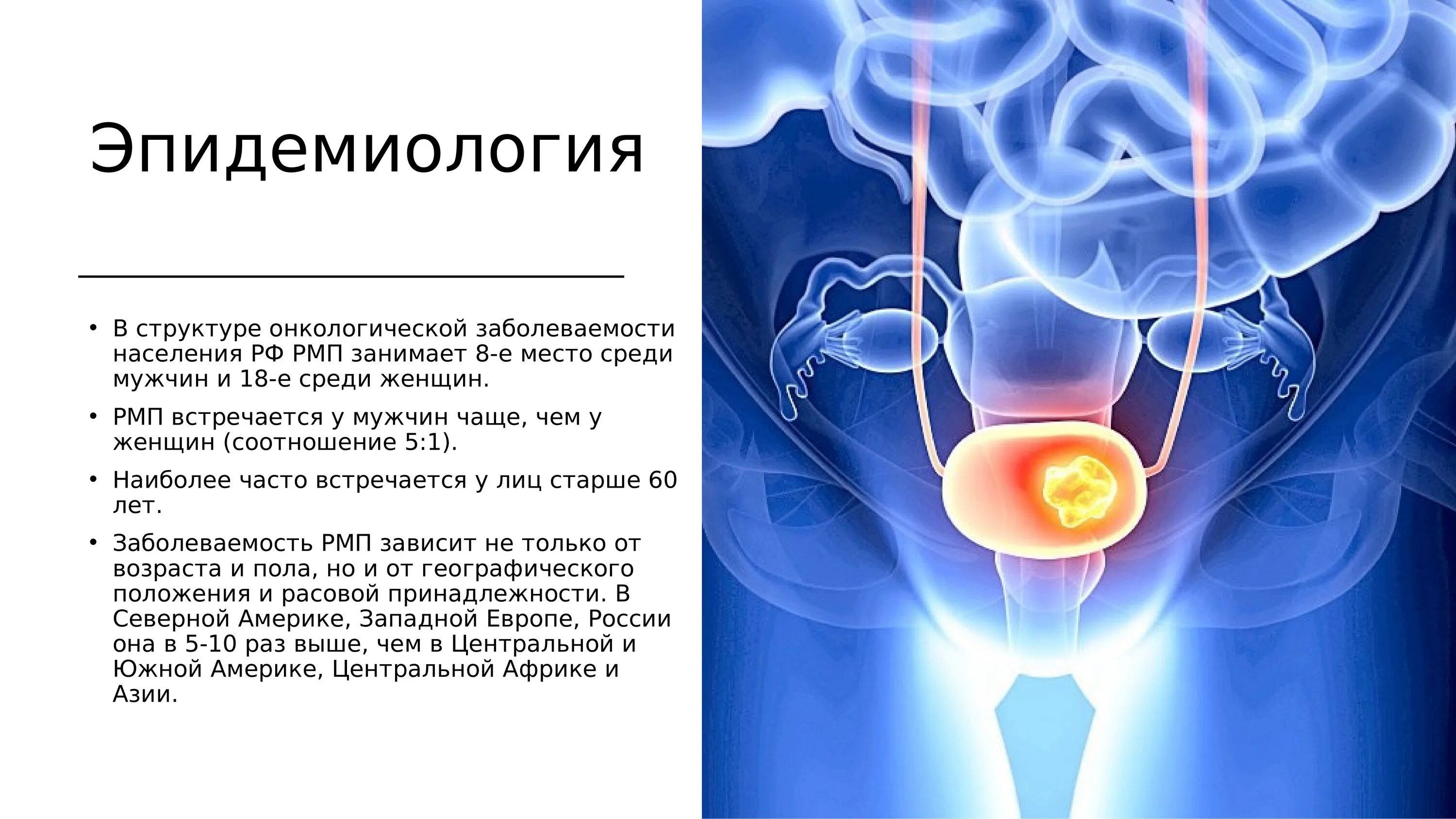 Боль в мочеиспускательном канале. Опухолевые заболевания мочевого пузыря. Опухоли мочевого пузыря презентация. Мочевой пузырь для презентации. Опухолевые образования в мочевом пузыре.