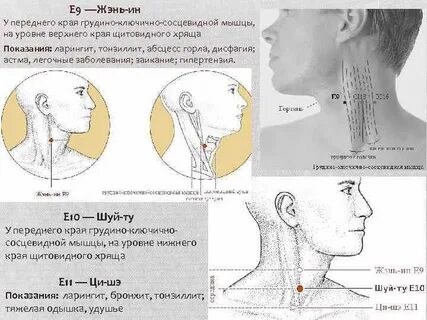 Массаж грудино ключичной мышцы