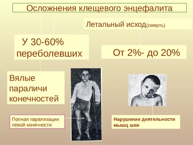 Энцефалит как заболевают. Последствия клещевого энцефалита. Клещевой энцефалит паралич. Осложнения при клещевом энцефалите.