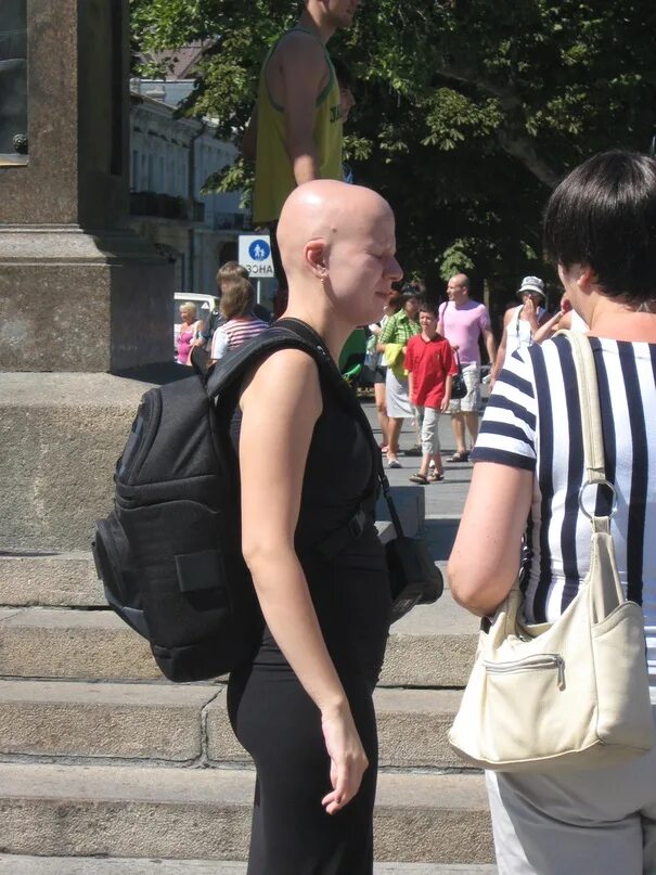 Лысая девочка ногу свело. Лысая девочка ногу свело. Лысая девочка ногу свело. Танцы nlo лысая девочка. Ногу свело песня идем на восток.