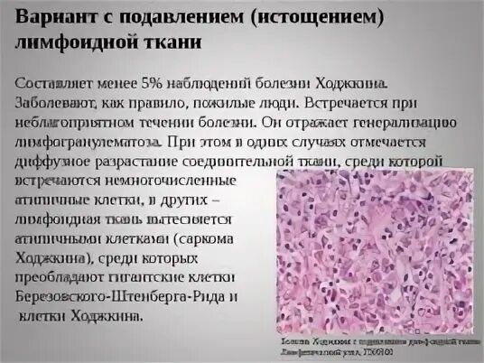 Гиперплазия лимфоидной ткани
