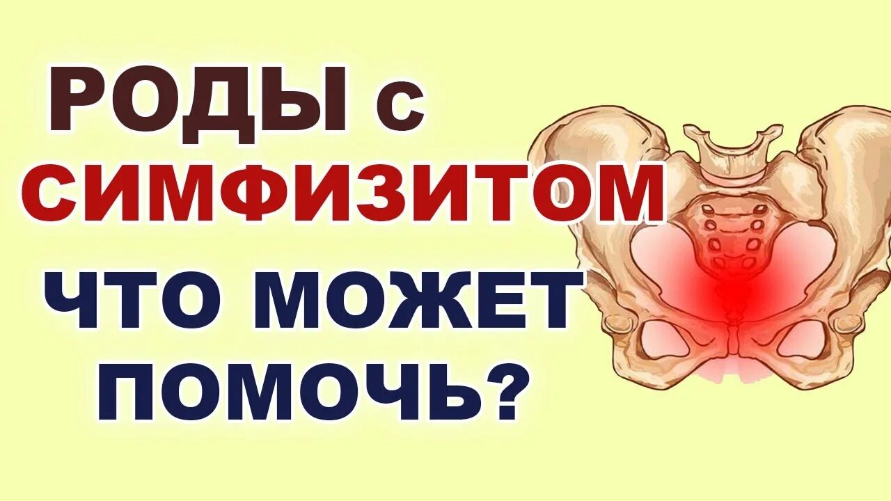 Симфизит при беременности что. Симфизит при беременности. послеродовой симфизит. гимнастика при симфизите после родов.