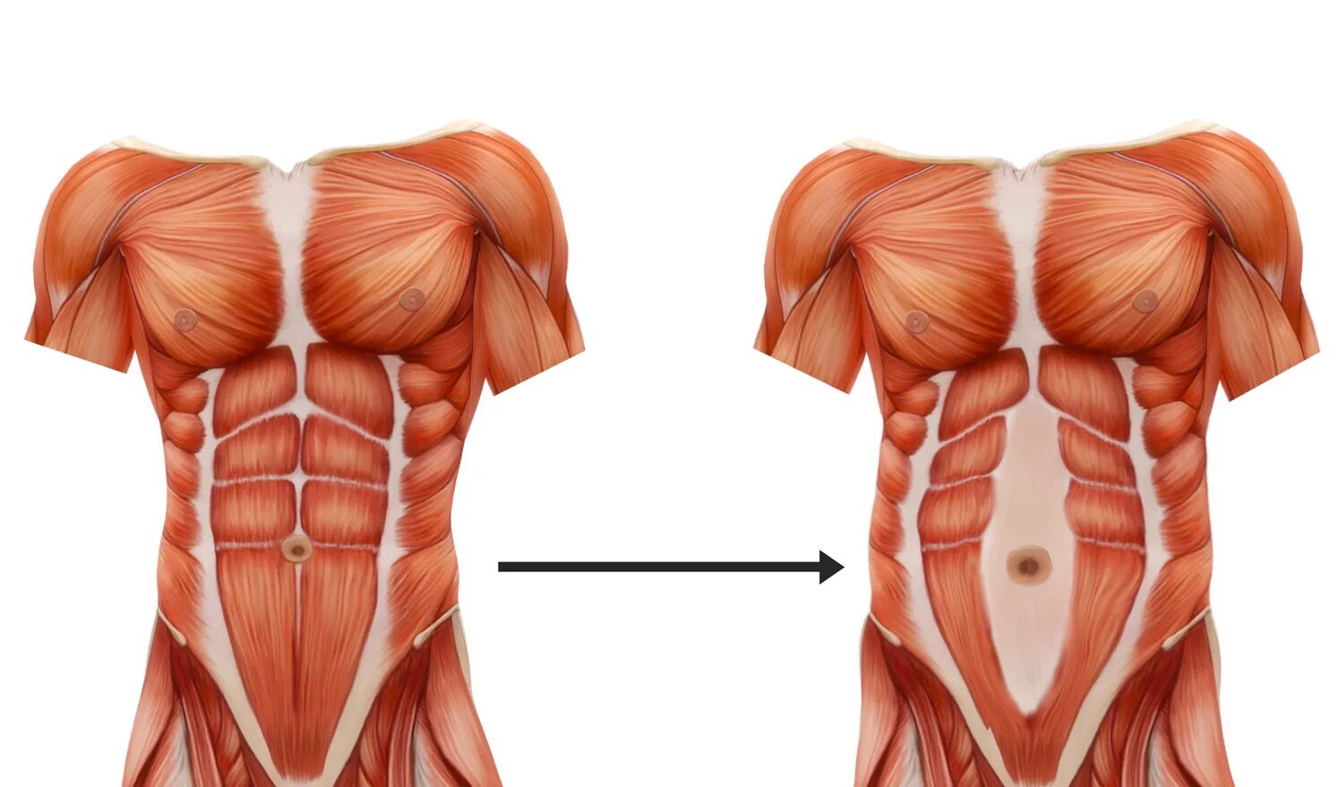 Прямые мышцы живота у мужчин. Мышцы пресса анатомия диастаз. Мышцы брюшного пресса у женщин.