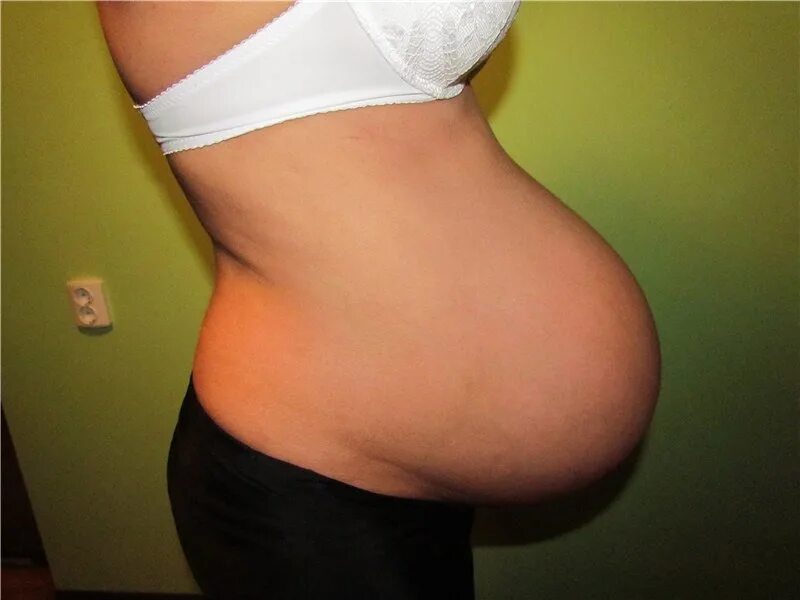 Острый беременный живот. Острая форма живота при беременности.