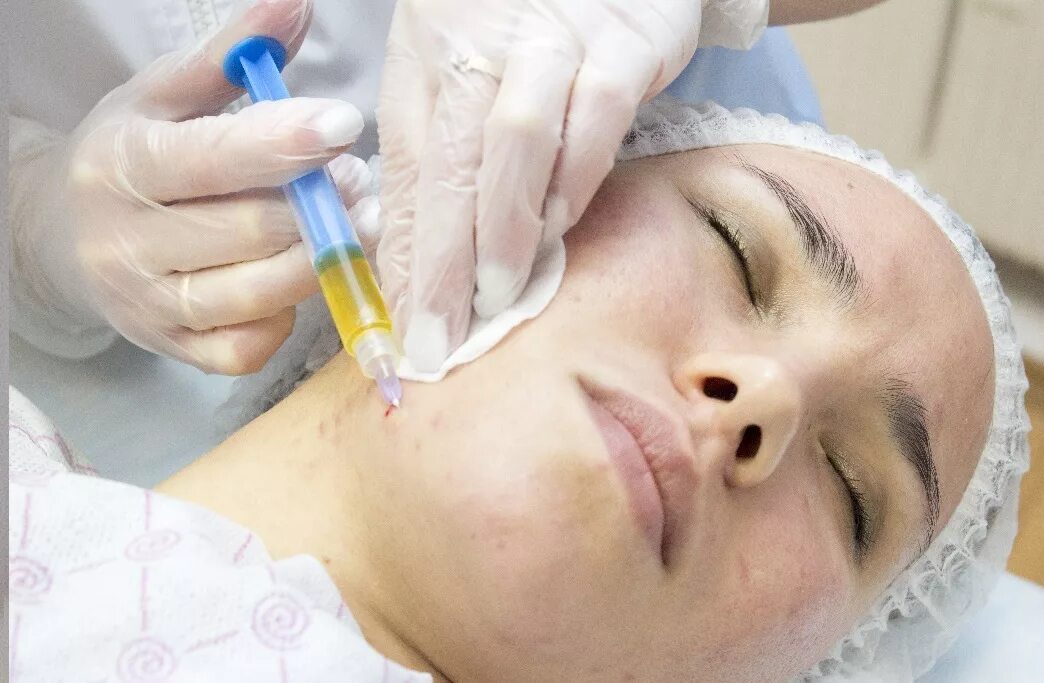 что такое плазмолифтинг в косметологии для лица. что такое плазмолифтинг в косметологии для лица. плазмолифтинг для лица. плазмотерапия плазмолифтинг. что такое плазмолифтинг в косметологии для лица.