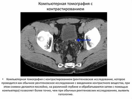 Кт без контрастного вещества