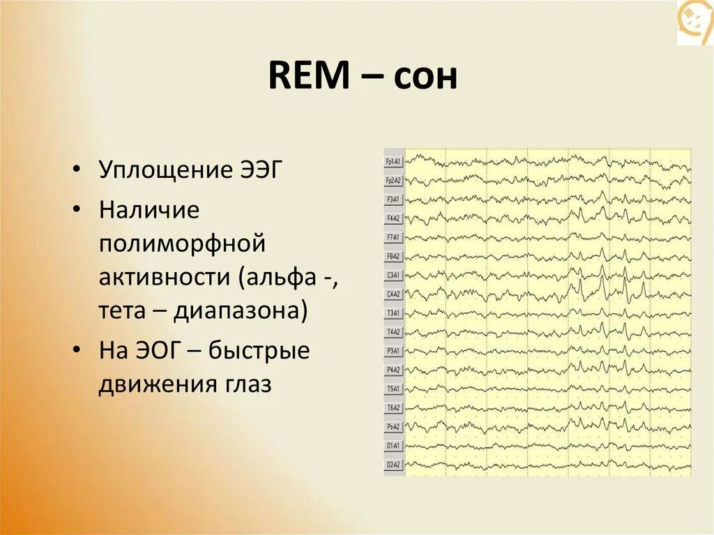 Rem фаза сна. Rem сон на ЭЭГ. Фазы сна Rem сон. Rem фаза сна ЭЭГ.