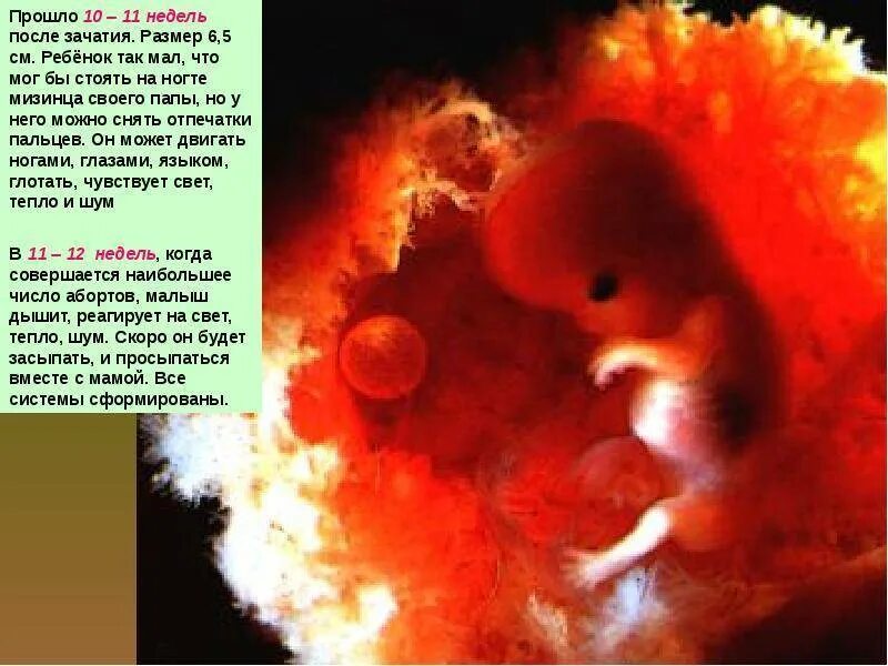 Три недели три дня беременности. Зародыш 2-3 недели беременности от зачатия. Эмбрион 4 недели беременности зачатия. Эмбрион на 4 неделе после зачатия.