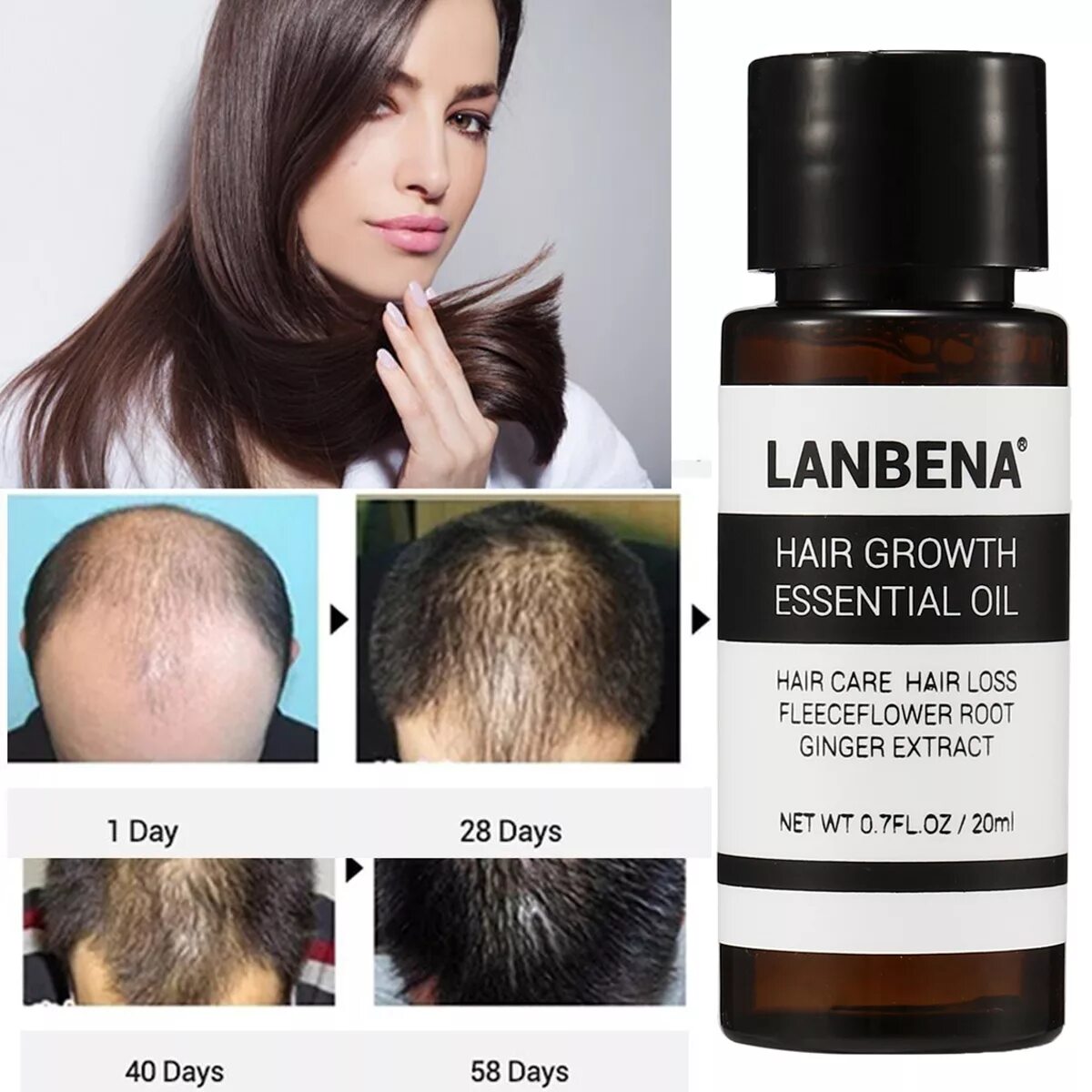 Отзывы рост волос на голове. LANBENA hair growth. LANBENA hair growth Essential Oil. Масло для волос LANBENA hair growth Essential Oil. LANBENA для роста волос.