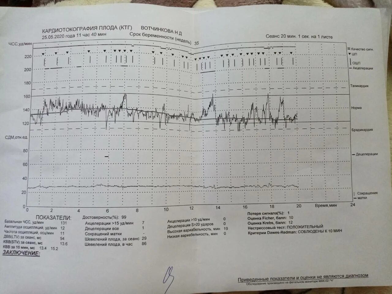 Схватки на 32. КТГ при беременности 37 недель норма таблица. Маточный датчик КТГ норма. КТГ постановка датчиков. Оценка состояния плода методом КТГ.