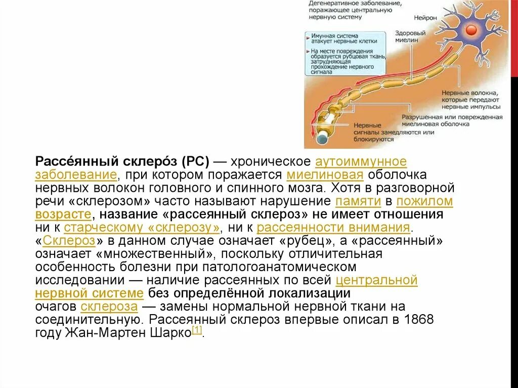 История болезни рассеянный