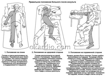 После инсульта не работает правая нога