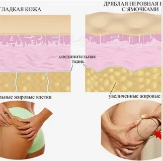 Подкожные жировые отложения