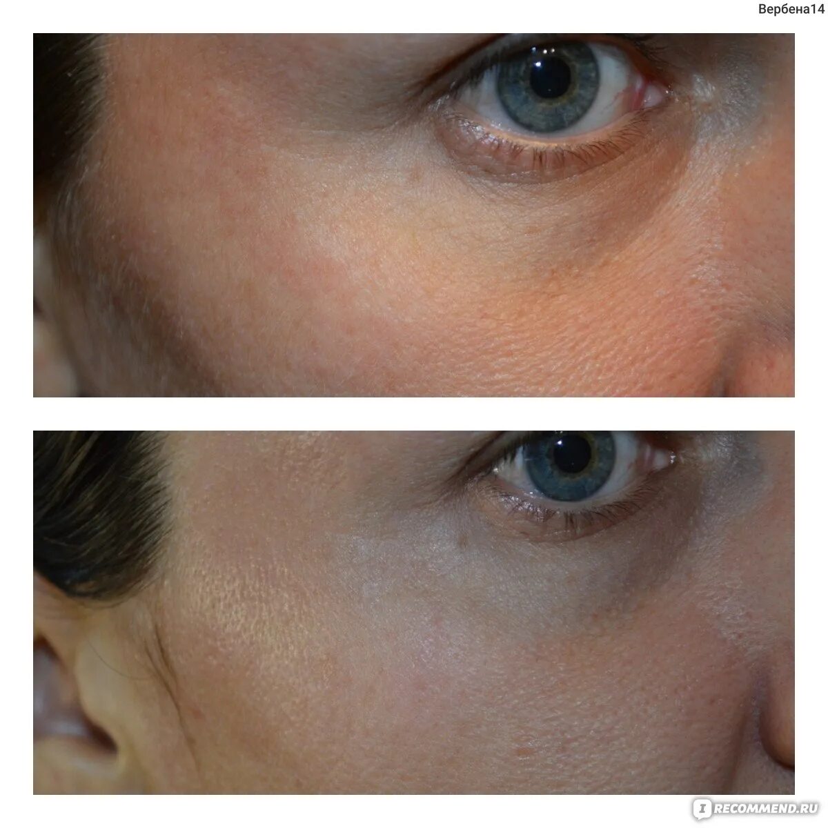Альгинатная маска эффект до и после. Альгинатные маски до после. Альгинатная маска для лица эффект до и после. До и после альгинатной маски. Альгинатная маска до и после