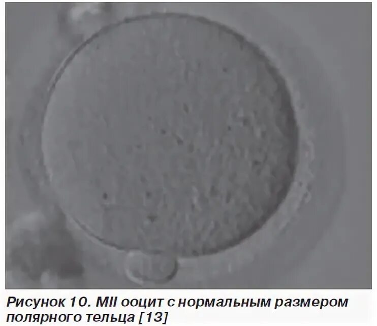 Созревание полярных телец. Ооцит GV. Полярное тельце. Полярные тельца первого порядка набор генетического материала. Ооцит кумулюсный комплекс.