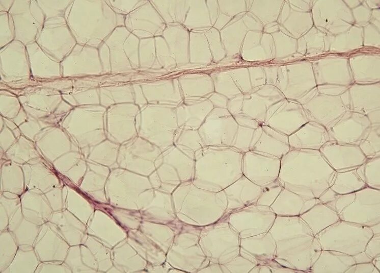 File:Yellow adipose tissue in paraffin section - lipids washed out.jpg - Wikiped