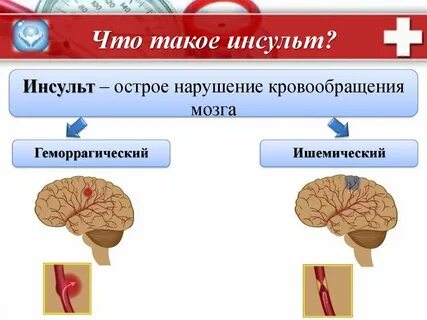 Инсульт что это такое