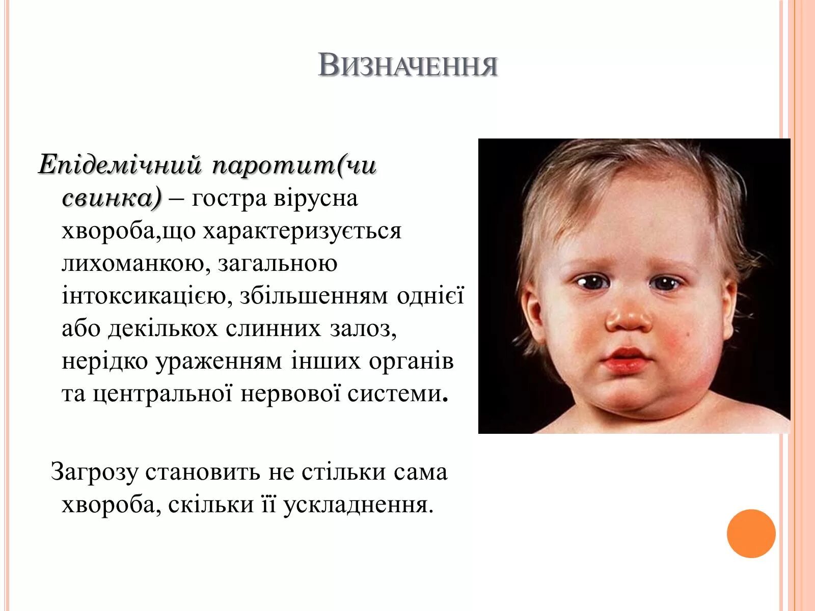 Прививка паротит краснуха отзывы. Корь-краснуха-паротит прививка. Корь краснуха паротит вакцина.