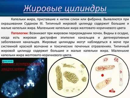 Капли мочи