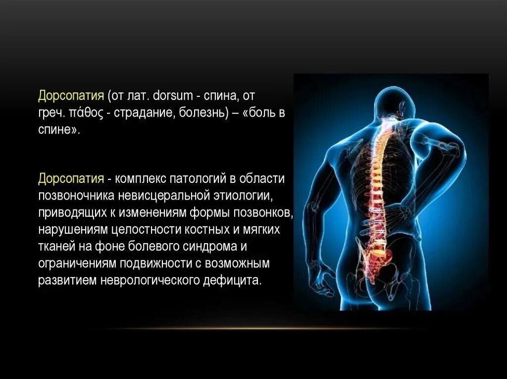 Неврологические боли в спине. Дорсопатия. Дорсопатия шейного отдела позвоночника. Дорсопатии шейного отдела позвоночника. Дорсопатия поясничного отдела позвоночника.