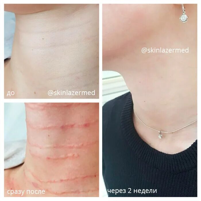 Сразу после заполнения