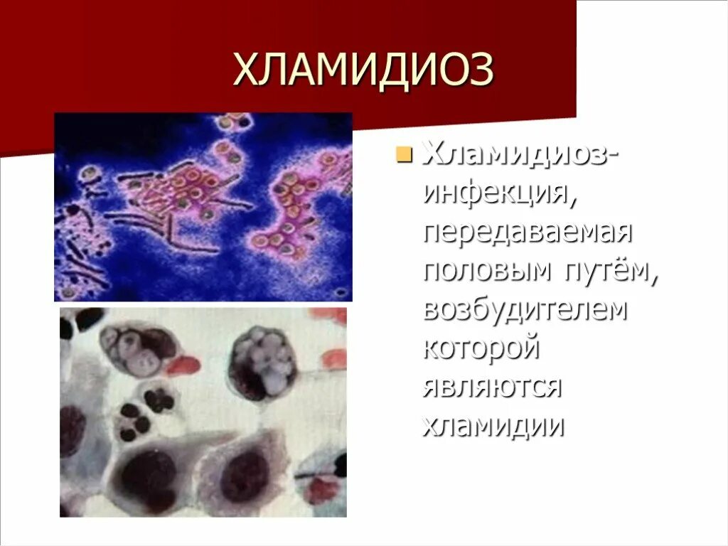 Хламидии как выглядят. Урогенитальный хламидиоз Дерматовенерология.