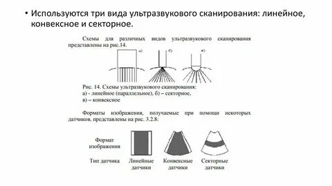 Виды ультразвуковых