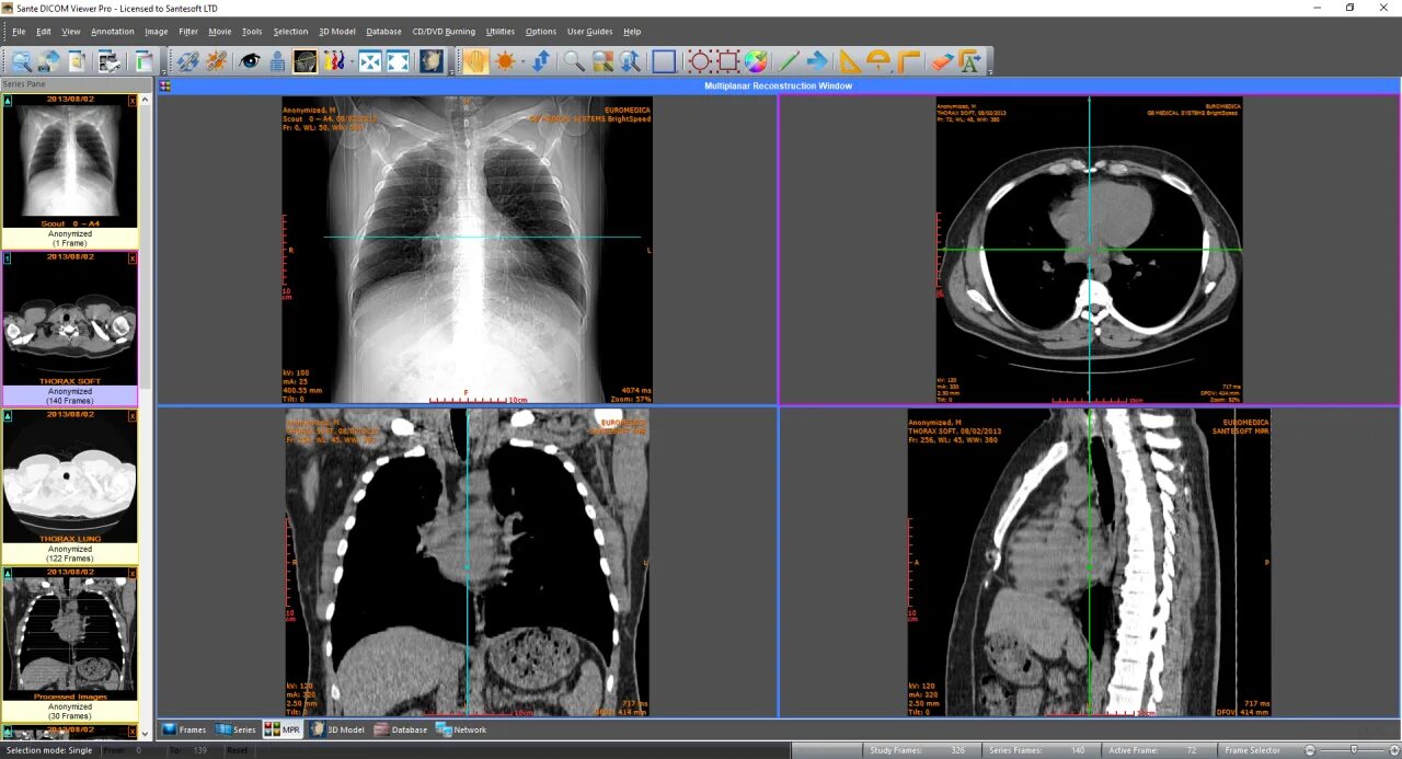 Dicom viewer. Sante dicom viewer pro. стандарт dicom. симуляция dicom. диск формат dicom.