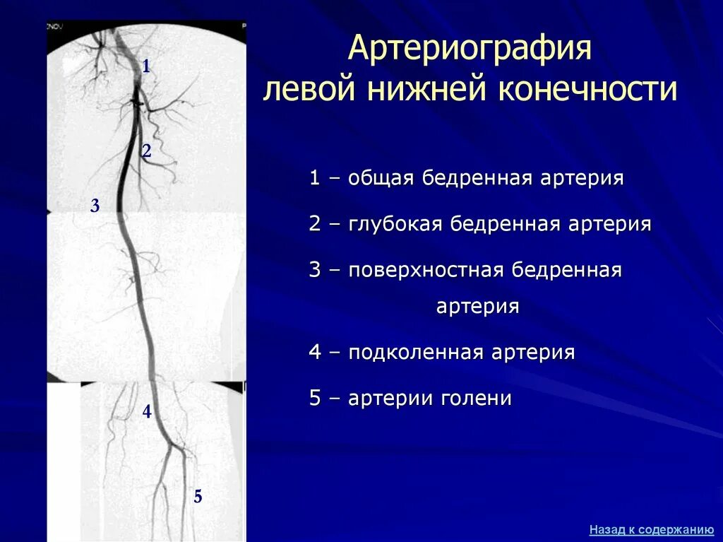 Аорты нижних конечностей. Артерии голени кт ангиография. Артерии нижних конечностей кт анатомия. Сосуды нижних конечностей кт анатомия. Ангиография сосудов нижних конечностей.