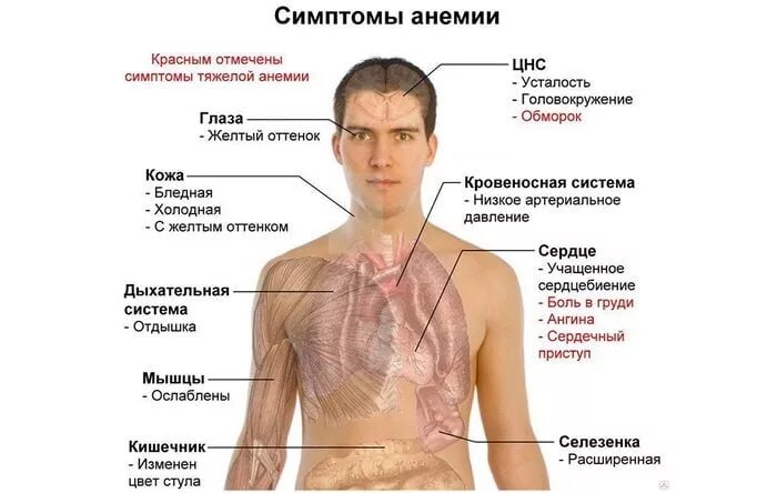 Как проверить анемию