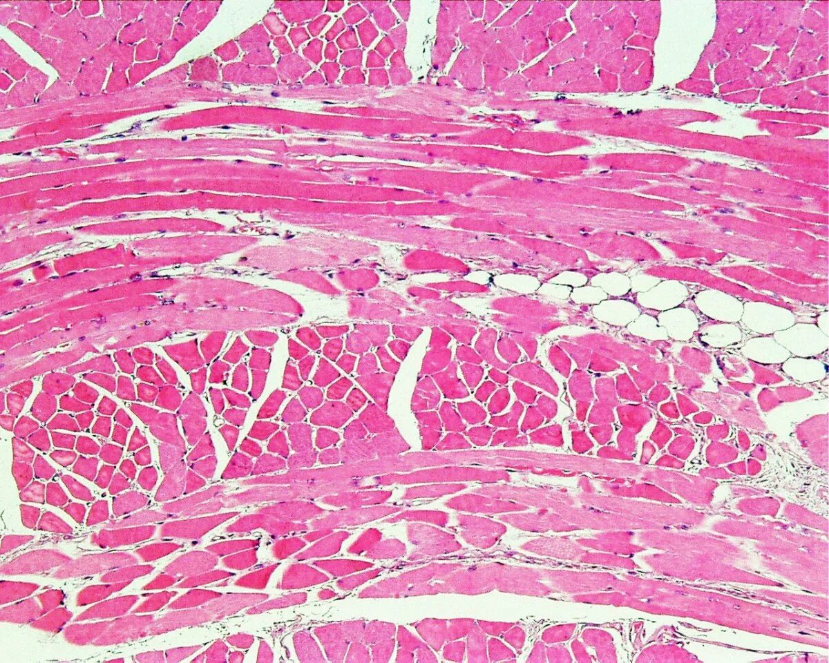 Скелетная мышечная ткань гистология препарат. Миокард микропрепарат гистология. Поперечно-полосатая мышечная ткань препарат гистология. Поперечно полосатая Скелетная мышца гистология препарат. Препарат поперечно полосатая мышечная ткань
