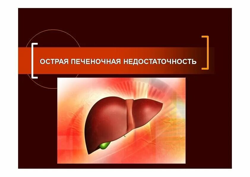 Острая печеночная недостаточность клиника. Острая печеночная недостаточность и цирроз печени. Портально печеночная недостаточность. Признаки острой печеночной недостаточности.