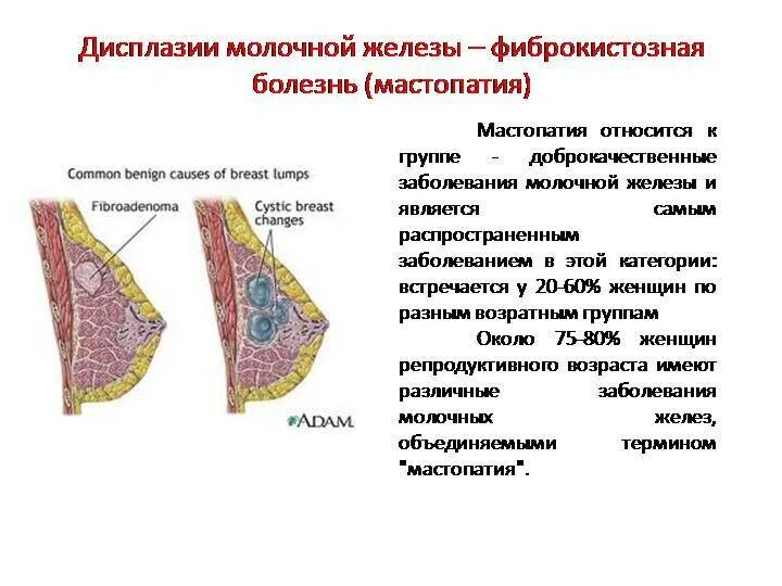 Что означает фиброзное изменение