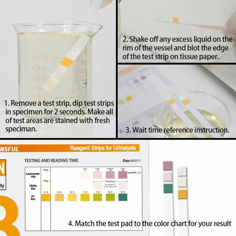 Тест лейкоциты в моче