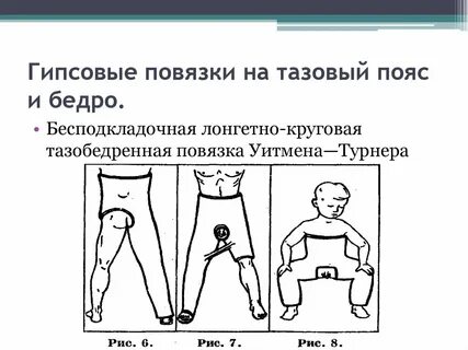Тазобедренная повязка