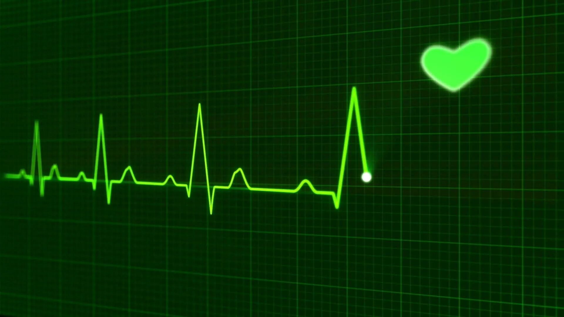 Сердце учащенное сердцебиение. Кардиограмма сердца. "Ритм" (сердечный). Линия пульса. Кардиограмма остановки сердца.
