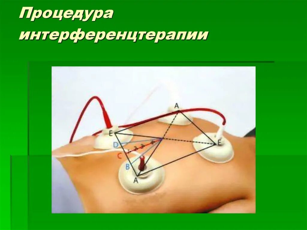 Интерференция токов