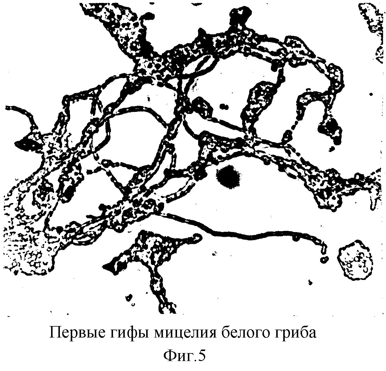 Обнаружены споры и мицелий. Грибница мицелий. Мицелий высших грибов. Мицелий заражен.