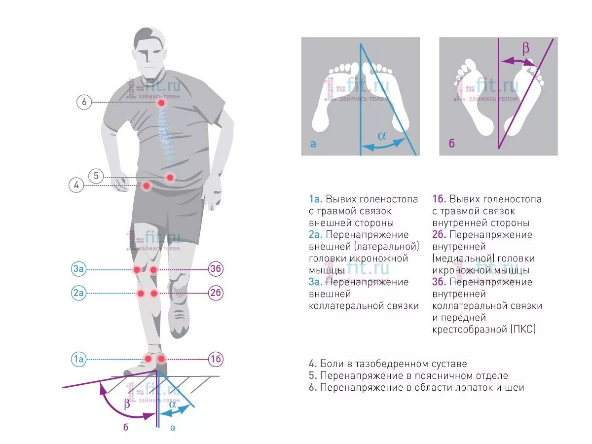Болит колено после бега с внутренней стороны сбоку. После бега болит стопа сбоку с внешней стороны. При беге болит под коленом спереди. Травмы мышц стопы при беге. Причина боли в правом тазобедренном суставе