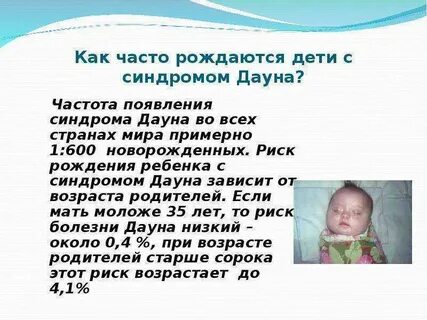 Какими рождаются дауны